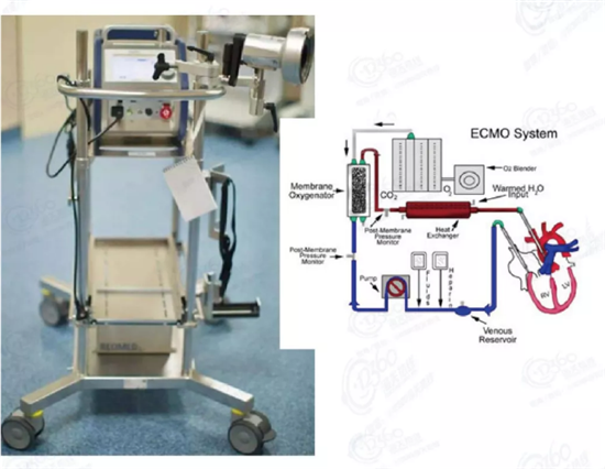 體外膜肺氧合(ECMO)設備
